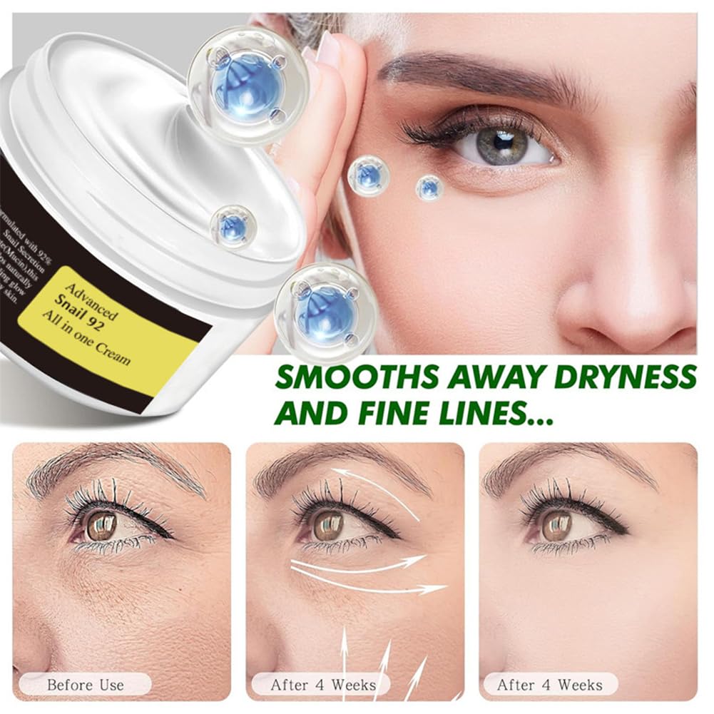 NAILKISS 92% Snail Mucin Repair Cream, Snail Mucin Repair Moisturizing Cream, Face Cream for All Skin Types, Anti-Aging Day & Night Cream - 3.52 oz